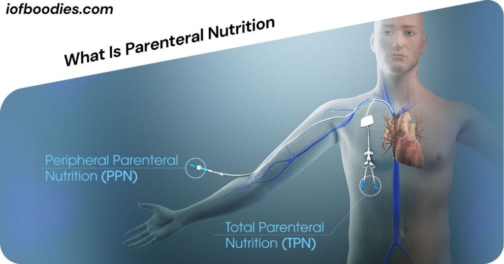 What Is Parenteral Nutrition